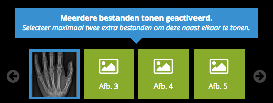 tonen van meerdere bestanden